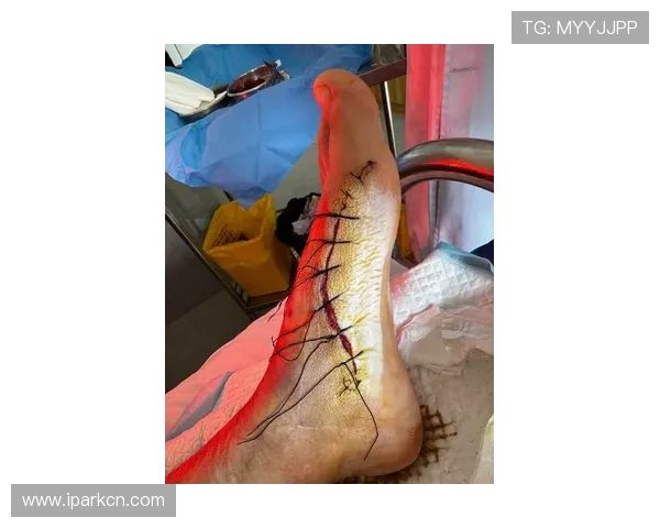 武磊膝微骨折手术内幕曝光真相